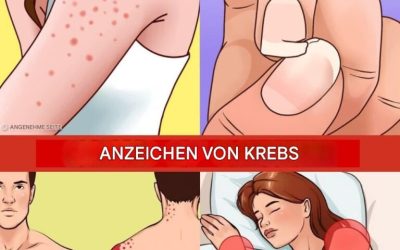 12 Frühwarnzeichen, dass Ihr Körper möglicherweise Krebszellen entwickelt
