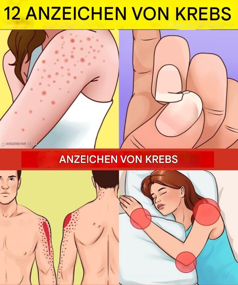 12 Frühwarnzeichen, dass Ihr Körper möglicherweise Krebszellen entwickelt
