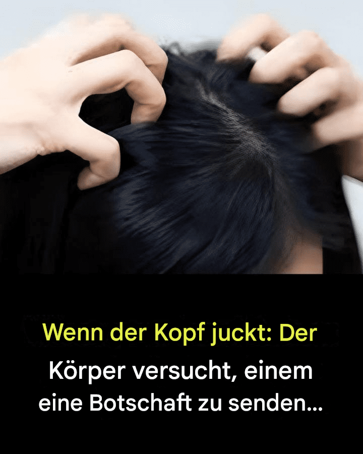 Juckende Kopfhaut? Hier sind die häufigsten Ursachen.