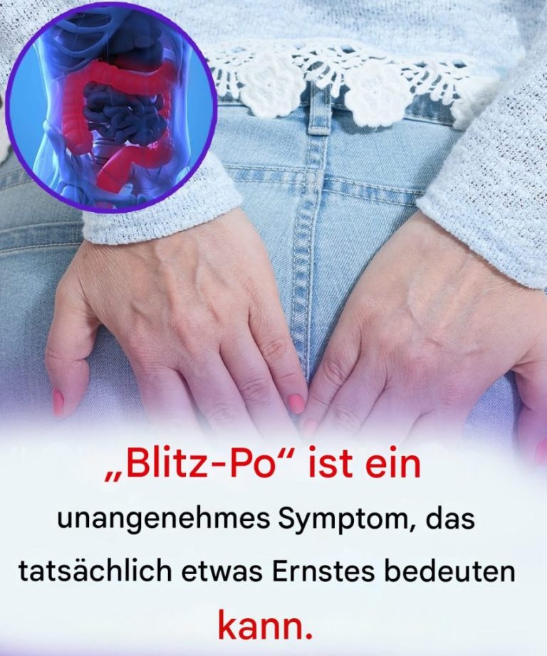 „Blitz-Po“ ist ein unangenehmes Symptom, das tatsächlich auf etwas Ernstes hindeuten kann.