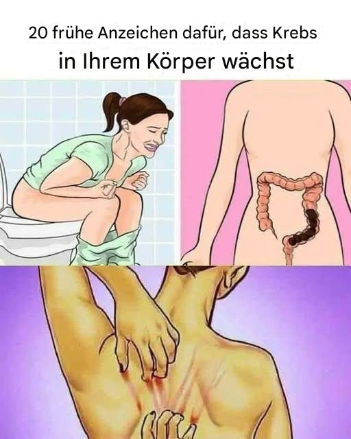 20 subtile Krebssymptome, die häufig übersehen werden