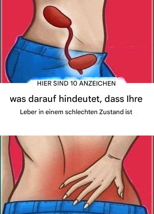 10 Anzeichen für eine ungesunde Leber