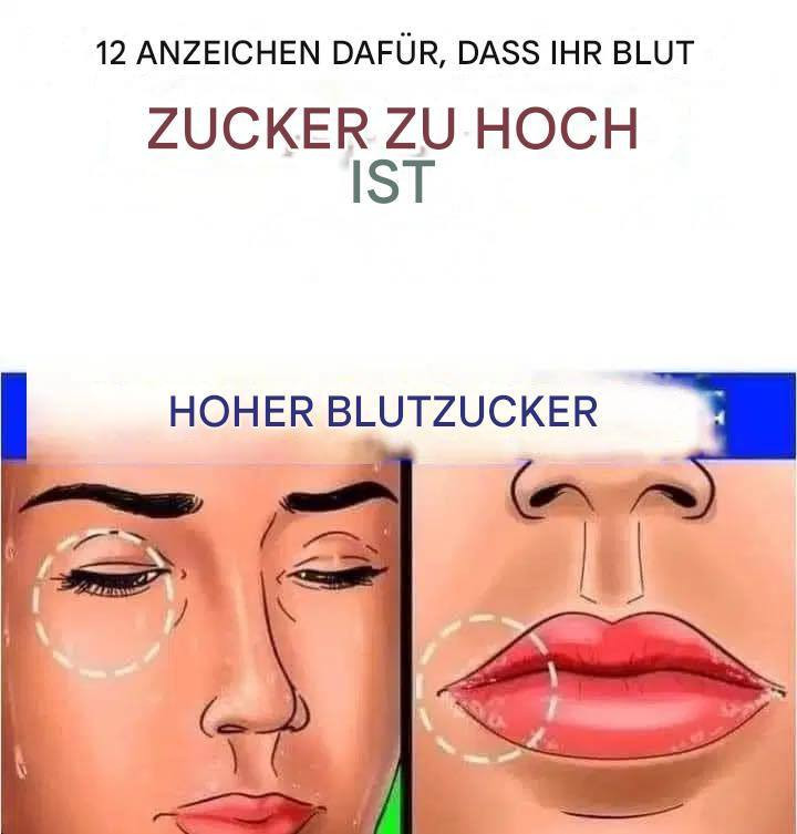 Wie Sie erkennen, ob Ihr Blutzucker zu hoch ist – 12 wichtige Symptome und Lösungen