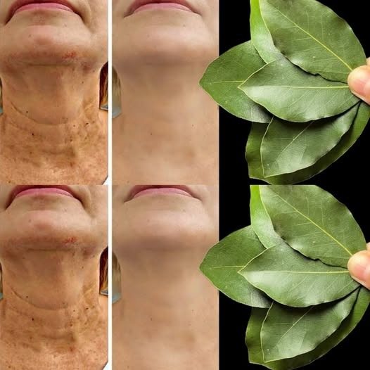 Lorbeerblatt ist 100.000 Mal wirksamer als Botox? | Natürlicher Faltenkiller – auch mit 70!