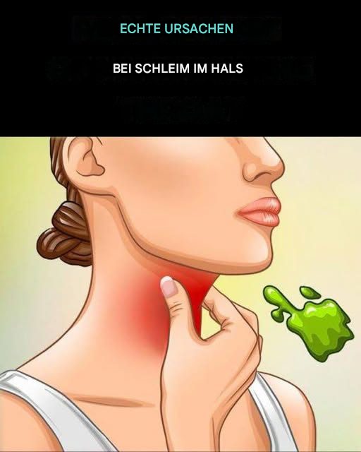 Die wahren Ursachen für ständigen Schleim und Schleim im Hals und wie man ihn loswird