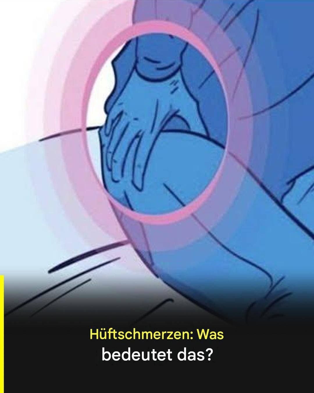 Wenn Ihre Hüfte schmerzt, könnte dies ein Warnsignal Ihres Körpers sein.