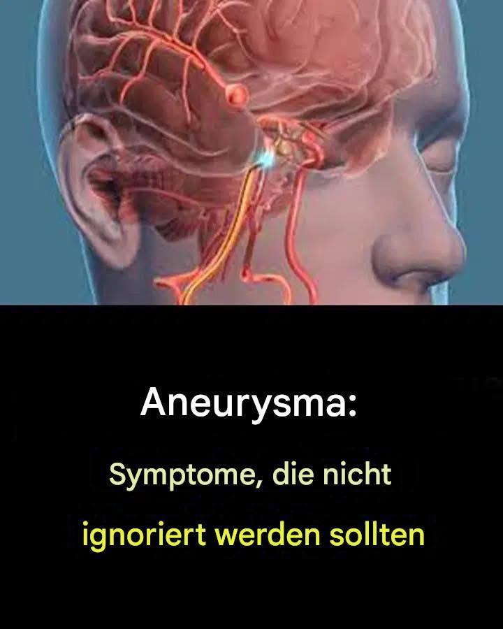 Aneurysma: Symptome, die Sie nicht ignorieren sollten