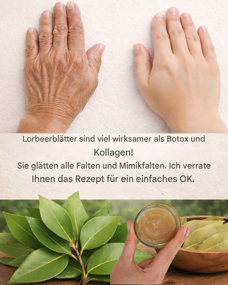Lorbeerblätter sind so viel wirksamer als Botox und Kollagen! Sie lassen Falten und feine Linien verschwinden.