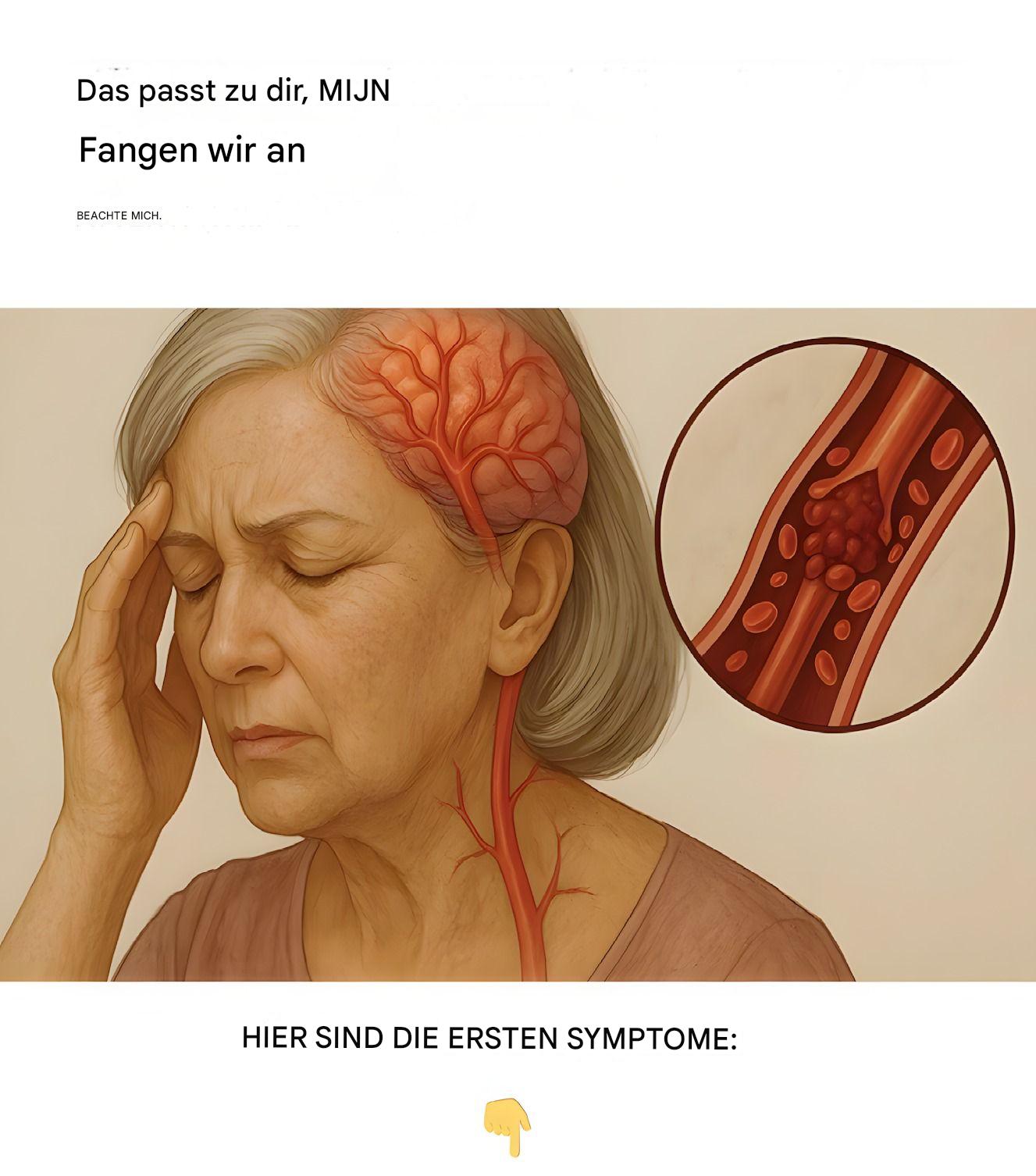 Einen Monat vor meinem Schlaganfall begann mein Körper mich zu warnen. Das waren die ersten Symptome.
