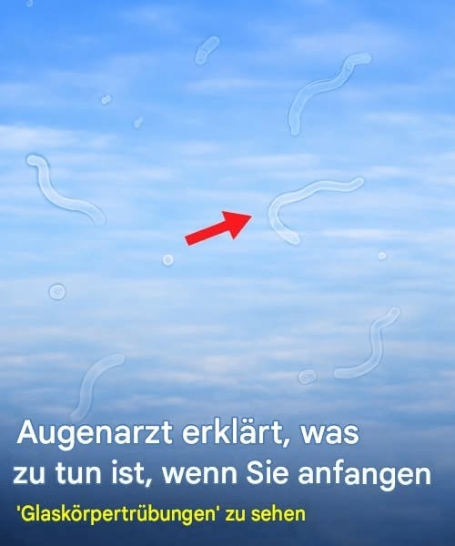 Glaskörpertrübungen verstehen: Ursachen, Symptome und hilfreiche Tipps